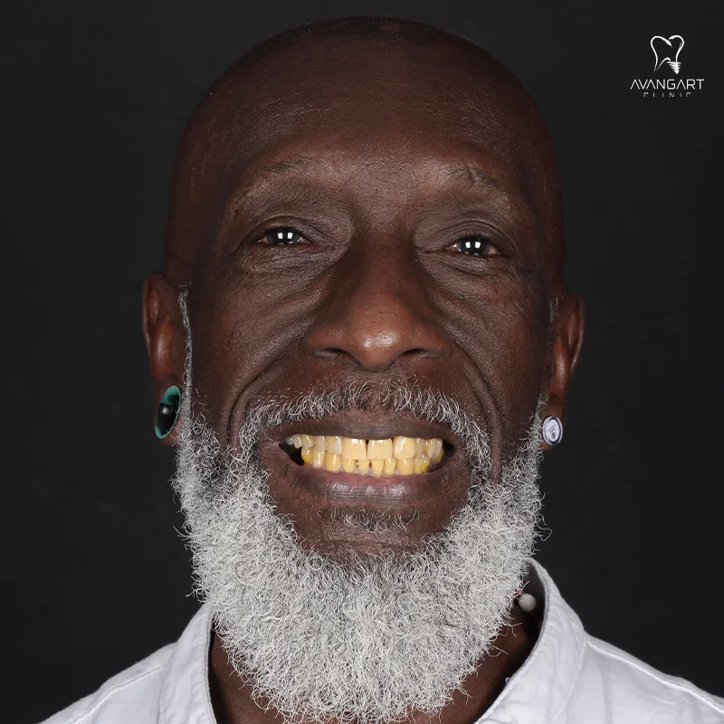 Wendel before Wendel before