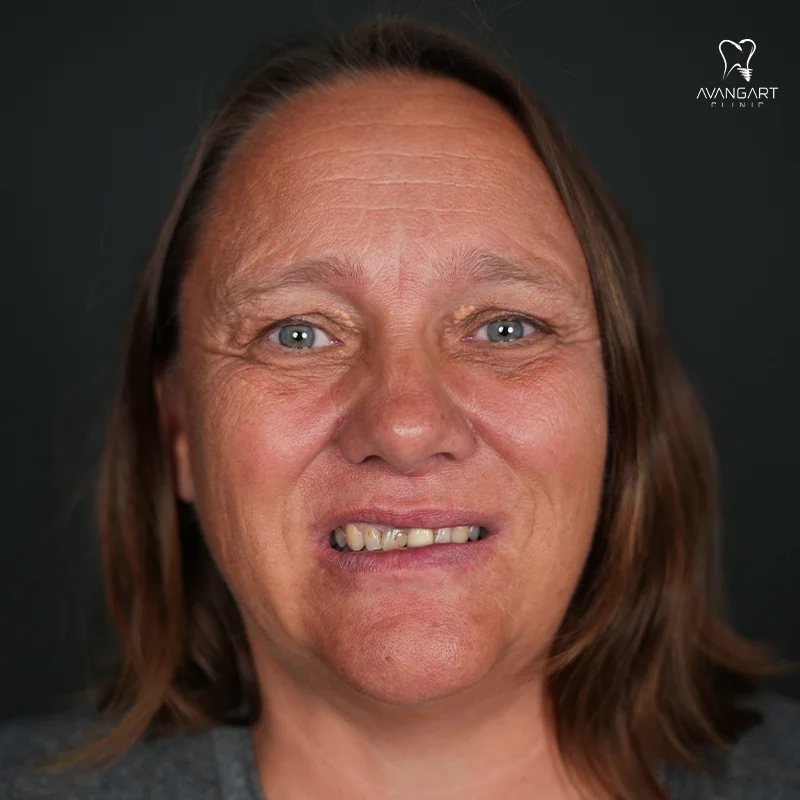 claudiabefore claudiabefore